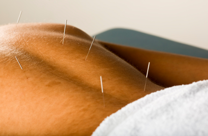 acupuncture, northstar natural